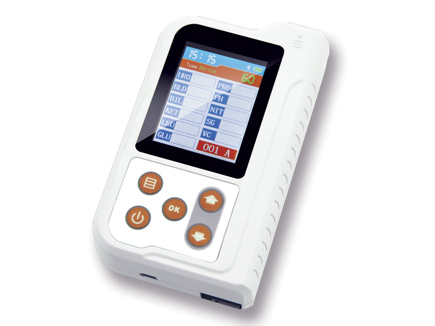 &quot;P16&quot; GIMA URINE ANALYZER