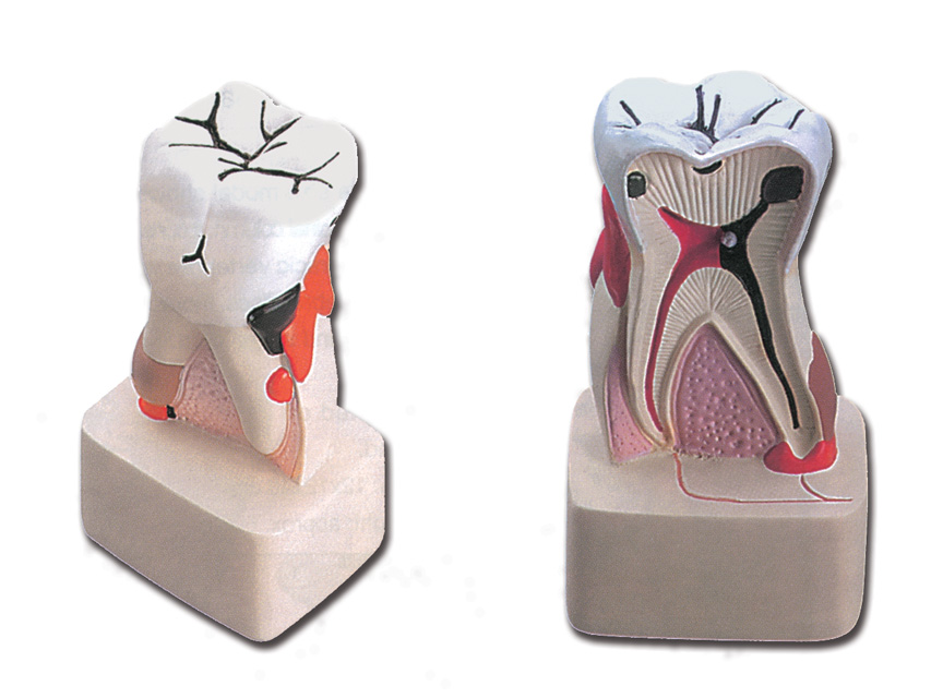 DENTAL PATHOLOGY - 4X