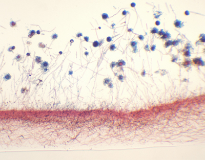 Aspergillus, s.e.