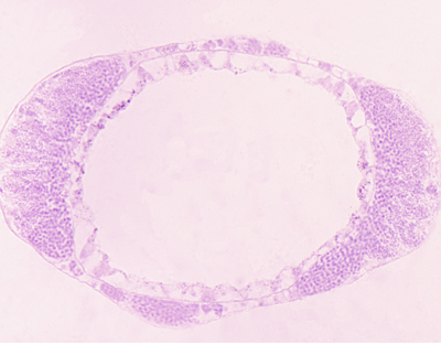 Testicule d'hydre, c.t.