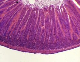 [135007095] Jéjunum, c.