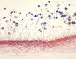 [135007142] Aspergillus, s.e.