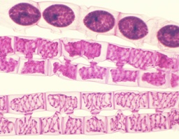 [135007147] Conjugaison de Spirogyra, s.e.