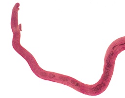 [135007297] Femelle de Schistosoma, s.e.